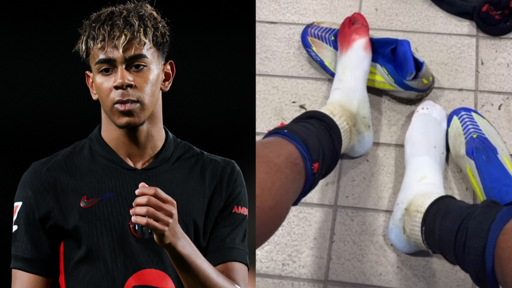 Lamine Yamal bloodied sock Barcelona Las Palmas 2024-25