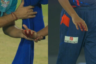 IPL 2025: Shubman Gill's fierce strike hits Akash Singh, suffers heavy bleeding