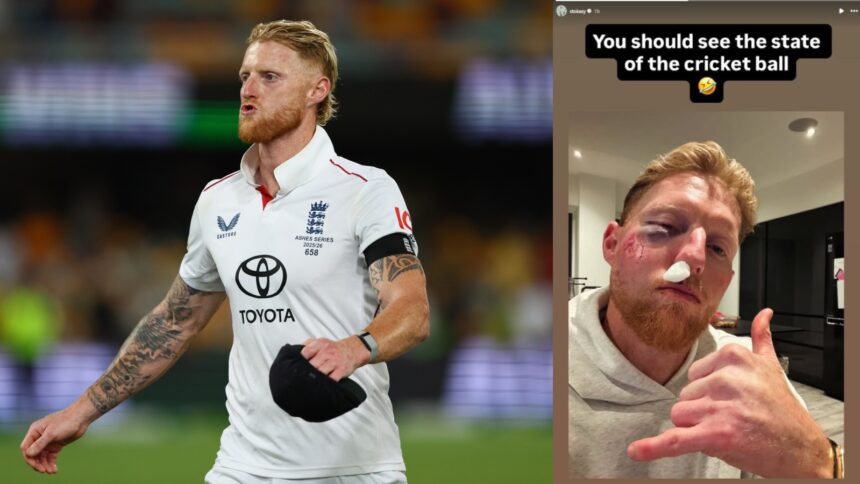 Ben Stokes injury